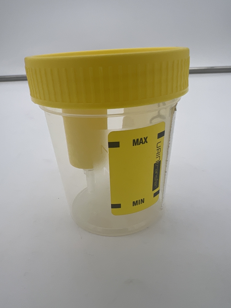 Pot à urin transparent avec couvercle jaune;
